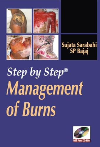 Step by Step Management of Burns