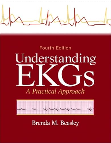 Understanding EKGs: A Practical Approach