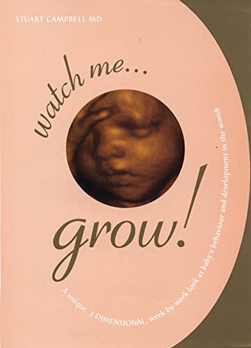 Watch Me Grow!: A Unique, 3-Dimensional, Week-by-Week Look at Baby's Behavior and Development in the Womb