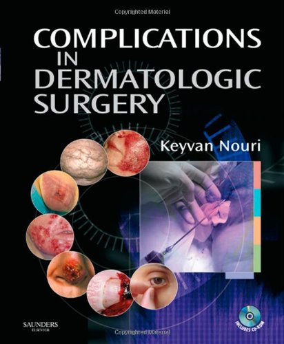 Complications in Dermatologic Surgery