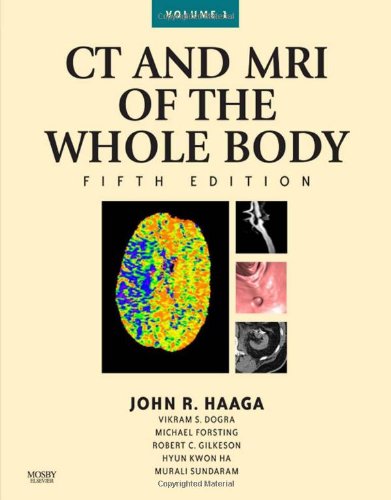 CT and Mri of the Whole Body, 2-Volume Set