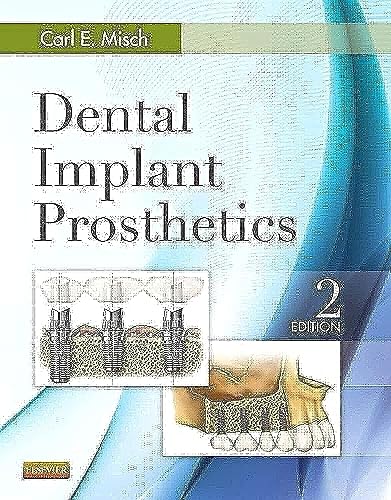 Dental Implant Prosthetics 2Ed (Hb 2015)