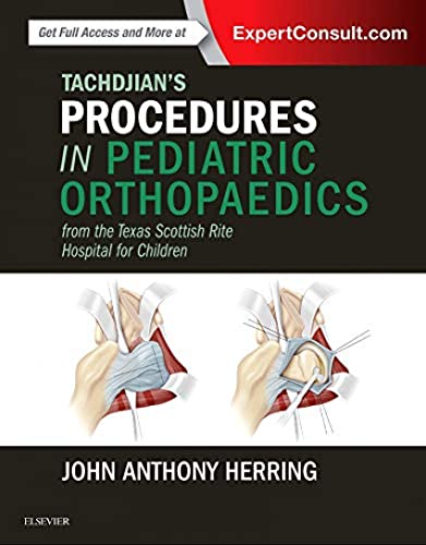 Tachdjian's Procedures in Pediatric Orthopaedics: From the Texas Scottish Rite Hospital for Children