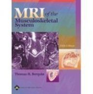 Mri: Musculoskeletal System