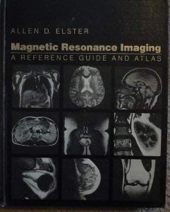 Magnetic Resonance Imaging: A Reference Guide and Atlas
