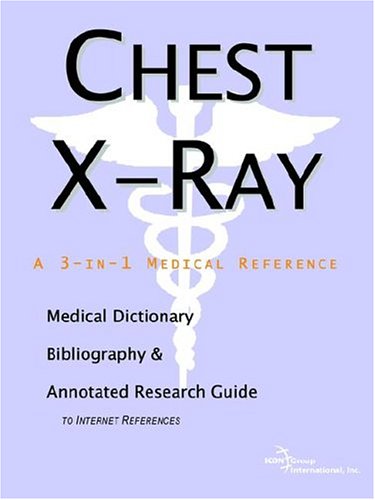 Chest X-ray: A Medical Dictionary, Bibliography, And Annotated Research Guide To Internet References