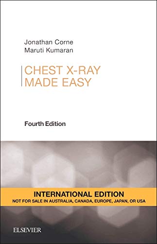 Chest X-Ray Made Easy, International Edition
