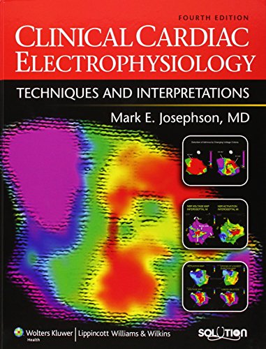 Clinical Cardiac Electrophysiology: Techniques and Interpretations