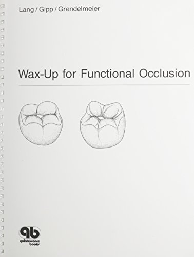 Wax-Up for Functional Occlusion: According to the Principles of Freedom in Centric