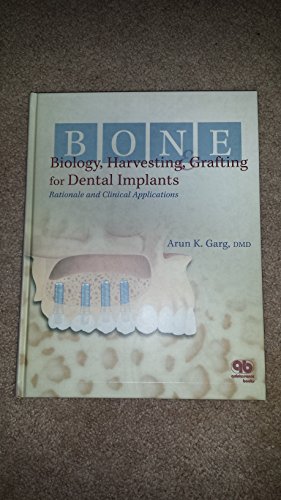 Bone Biology, Harvesting, & Grafting For Dental Implants: Rationale and Clinical Applications