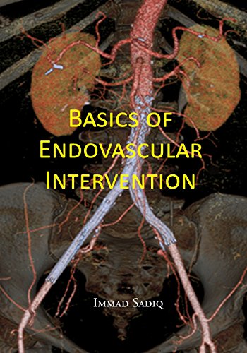 Basics of Endovascular Intervention
