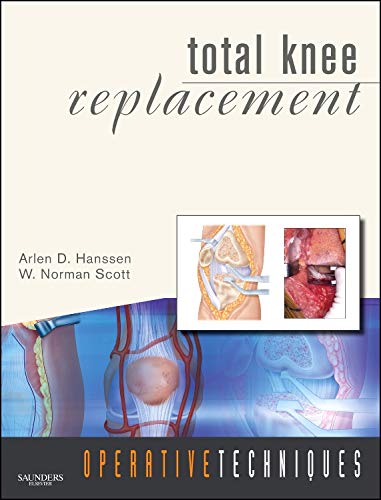 Total Knee Replacement