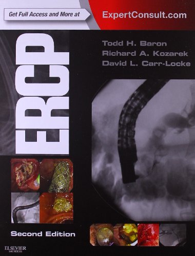 ERCP