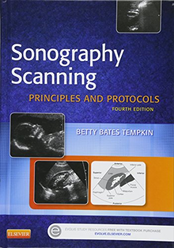 Sonography Scanning