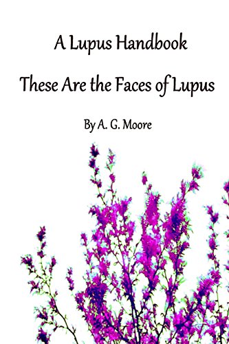 A Lupus Handbook: These Are The Faces Of Lupus