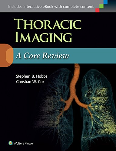 Thoracic Imaging: A Core Review: A Core Review. Includes interactive ebook with complete content