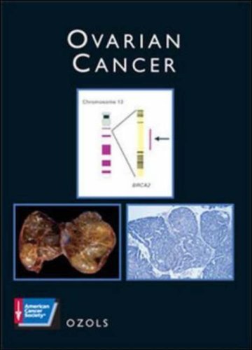 Ovarian Cancer: American Cancer Society Atlas of Clinical Oncology