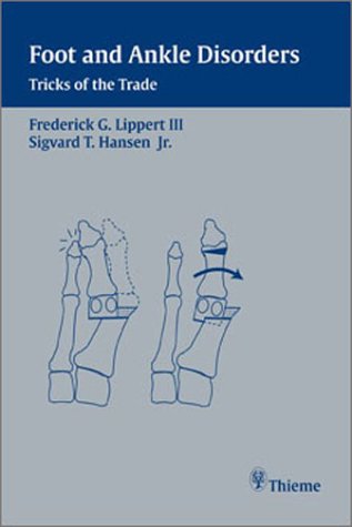 Foot and Ankle Disorders: Tricks of the Trade