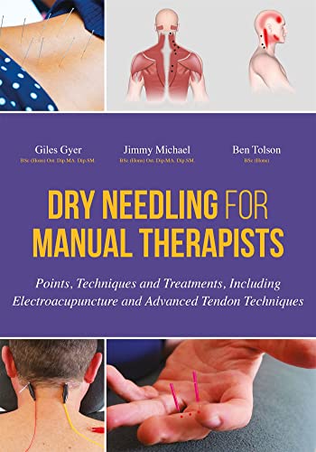 Dry Needling for Manual Therapists: Points, Techniques and Treatments, Including Electroacupuncture and Advanced Techniques