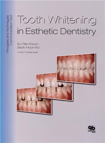 Tooth Whitening in Esthetic Dentistry: Principles and Techniques