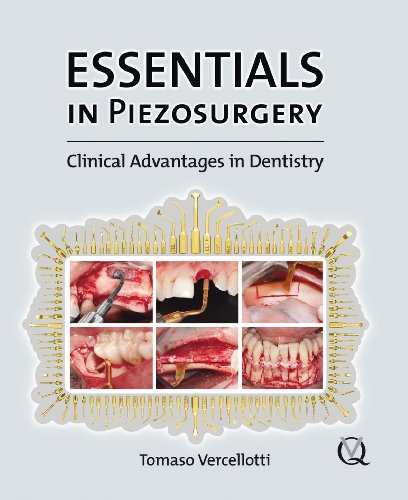 Essentials in Piezosurgery: Clinical Advantages in Dentistry