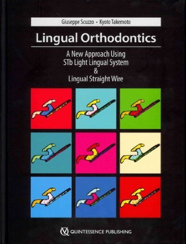 Lingual Orthodontics: A New Approach Using Stb Light Lingual System & Lingual Straight Wire