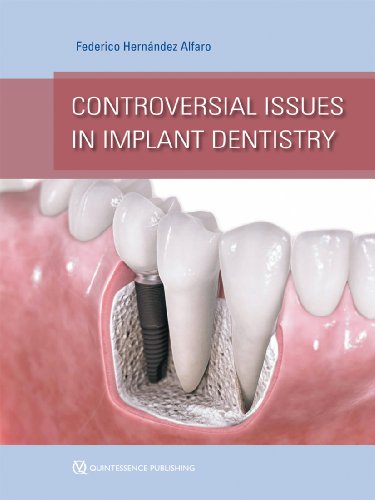 Controversial Issues in Implant Dentistry