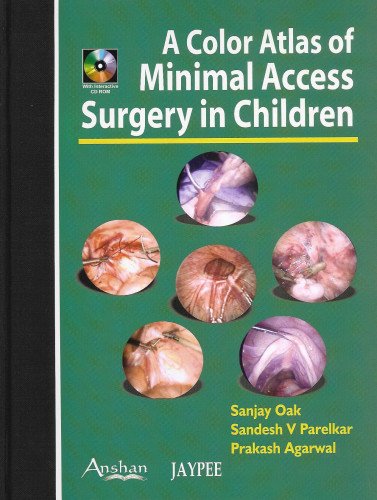 Color Atlas of Minimal Access Surgery in Children