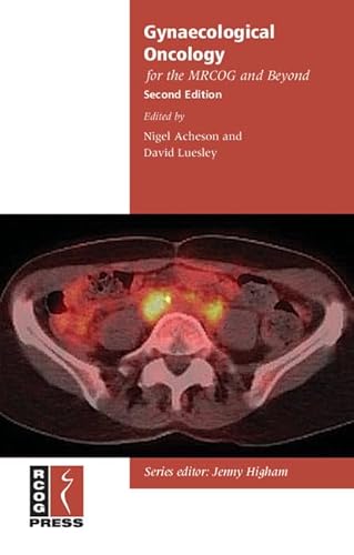 Gynaecological Oncology for the MRCOG and Beyond (Membership of the Royal College of Obstetricians and Gynaecologists and Beyond)