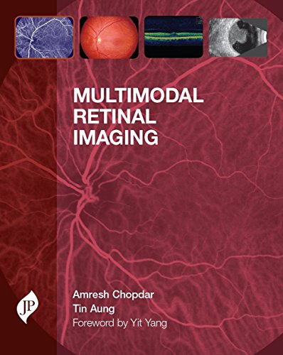 Multimodal Retinal Imaging