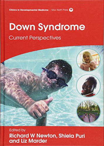 Down Syndrome: Current Perspectives