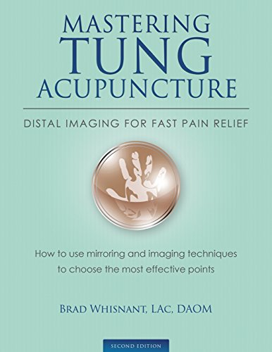 Mastering Tung Acupuncture - Distal Imaging for Fast Pain Relief: 2nd Edition