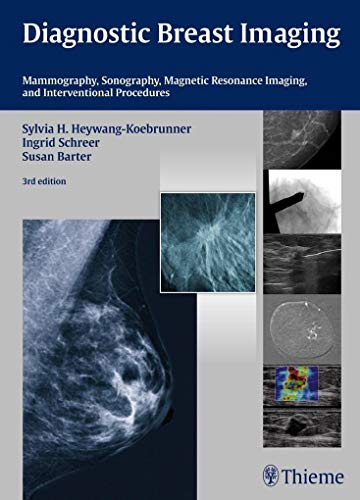 Diagnostic Breast Imaging: Mammography, Sonography, MRI and Interventional Procedures