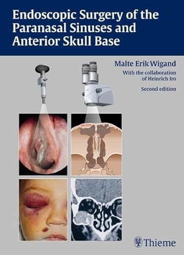 Endoscopic Surgery of the Paranasal Sinuses and Anterior Skull Base