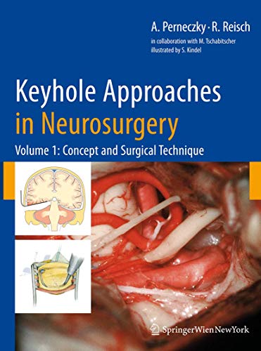 Keyhole Approaches in Neurosurgery: Volume 1: Concept and Surgical Technique