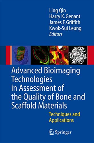Advanced Bioimaging Technologies in Assessment of the Quality of Bone and Scaffold Materials: Techniques and Application: Techniques and Applications