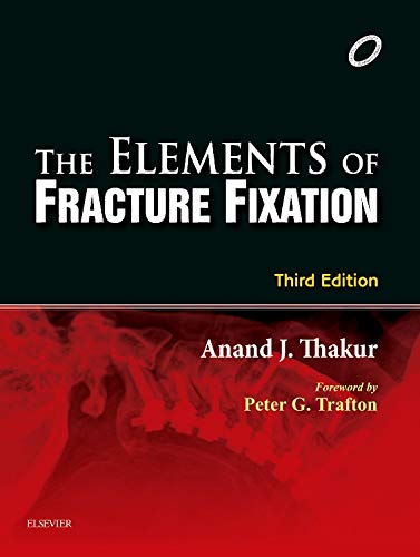 The Elements of Fracture Fixation