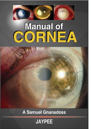 Manual of Cornea