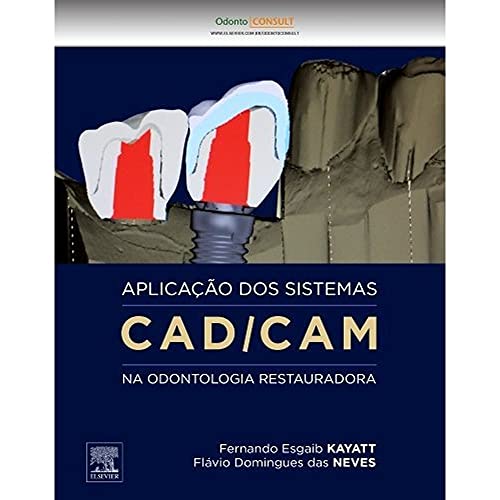 Aplicação dos Sistemas CAD/CAM na Odontologia Restauradora (Em Portuguese do Brasil)