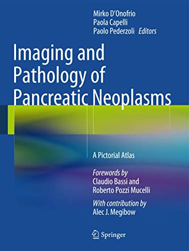 Imaging and Pathology of Pancreatic Neoplasms: A Pictorial Atlas