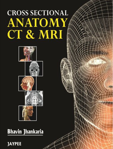 Cross Sectional Anatomy CT & MRI