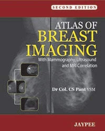 Atlas of Breast Imaging: With Mammography, Ultrasound and MRI Correlation
