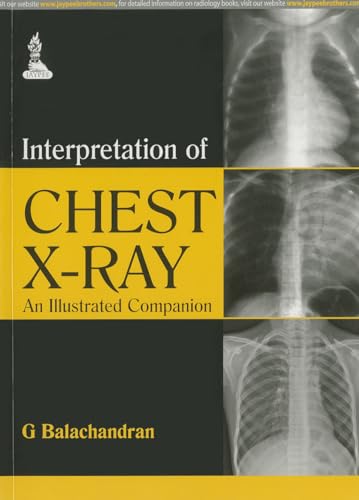 Interpretation of Chest X-Ray: An Illustrated Companion