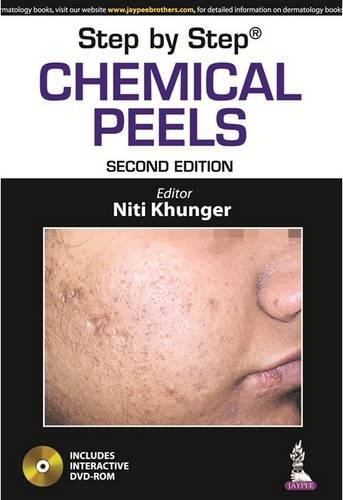 Step by Step Chemical Peels