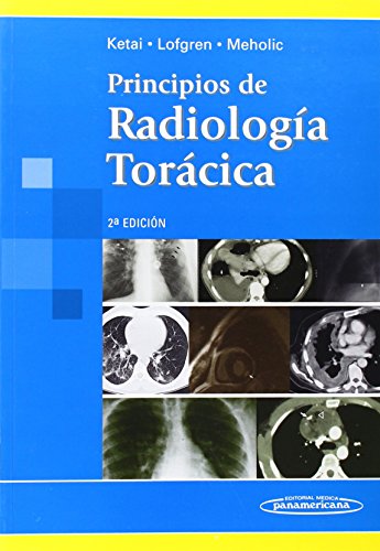 KETAI:Principios Radiolog a Tor cica (Spanish Edition)