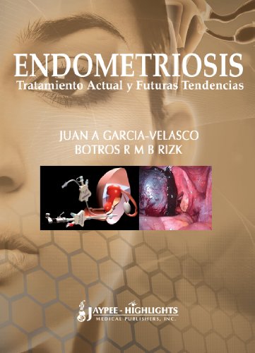 Endometriosis: Tratamiento Actual Y Futuras Tendencias / Current Treatment and Future Trends