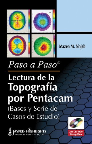 Paso a Paso Lectura De La Topografia Por Pentacam / Step By Step Reading Pentacam Topography