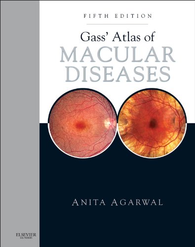 Gass' Atlas of Macular Diseases: 2-Volume Set - Expert Consult: Online and Print