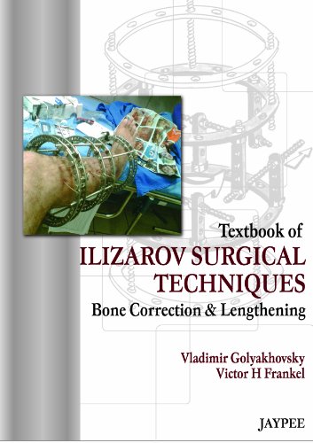 Textbook of Ilizarov Surgical Techniques: Bone Correction and Lengthening