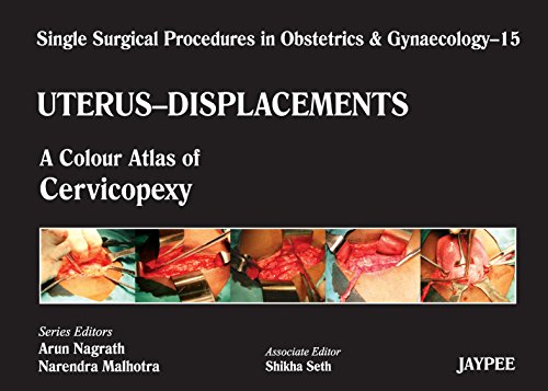 Single Surgical Procedures in Obstetrics and Gynaecology 15: A Colour Atlas of Cervicopexy: Single Surgical Procedures In Obs &Gyne